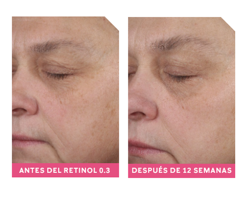 Retinol 0.3 Clinical Solutions