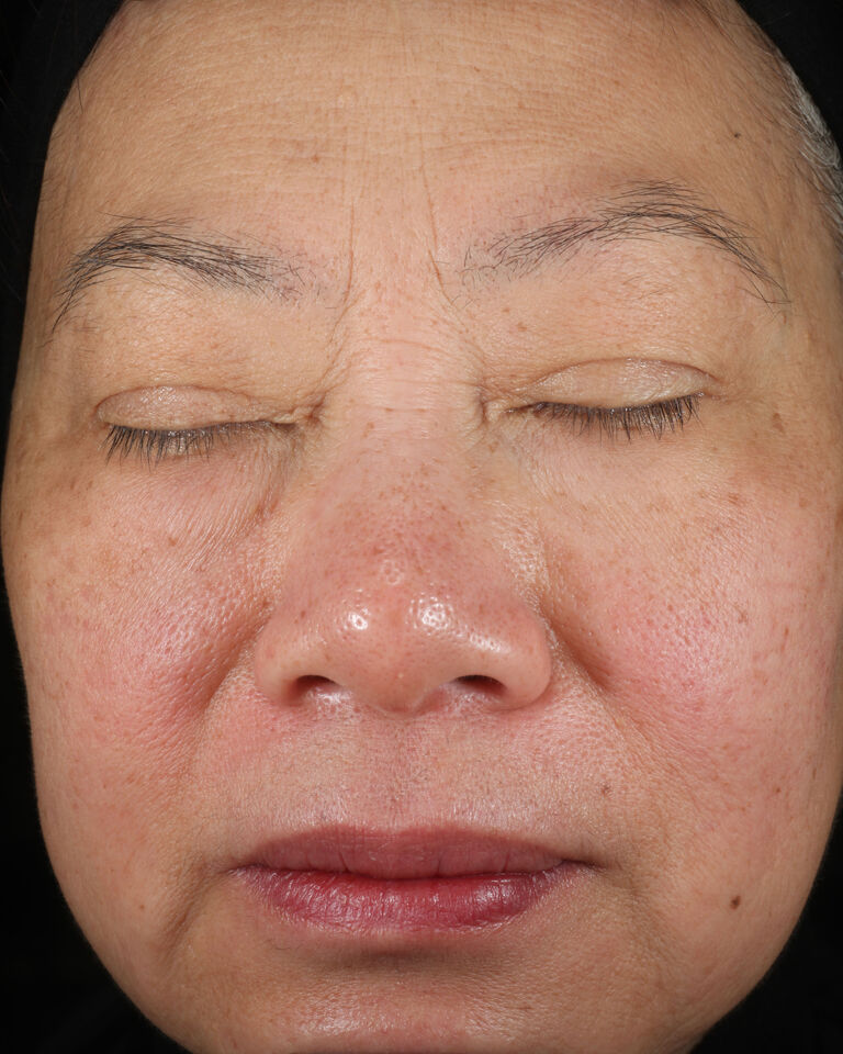 Antes de usar el S&eacute;rum Regenerador C+E TimeWise&reg; en la zona de las cejas.