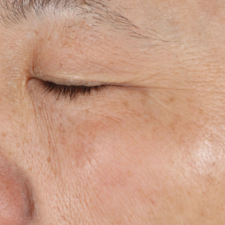 Despu&eacute;s de usar el S&eacute;rum Regenerador C+E TimeWise&reg; en la zona del contorno de ojos.