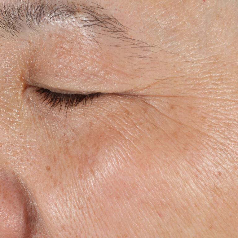 Antes de usar el S&eacute;rum Regenerador C+E TimeWise&reg; en la zona del contorno de ojos.