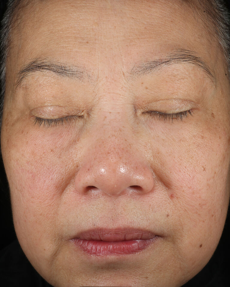 Despu&eacute;s de usar el S&eacute;rum Regenerador C+E TimeWise&reg; en la zona de las cejas.